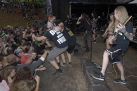 VULVODYNIA